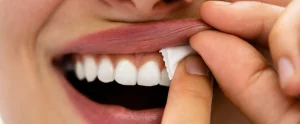 Smiling mouth showing gums possibly affected by nicotine pouch use